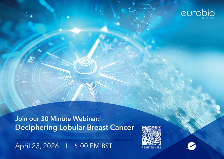 Deciphering Lobular Breast Cancer